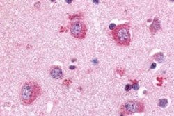 P2Y8 Antibody, Novus Biologicals 50 &mu;g | Buy Online | Novus Biologicals | Fisher Scientific